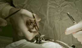 В 2025 году в Чеченской Республике проведено более 700 детских челюстно-лицевых операций