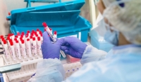 Минздрав ЧР: выплаты медикам, работающим с COVID-пациентами, предоставляются своевременно 