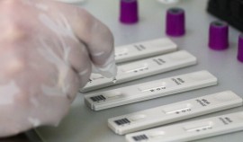 В России зарегистрирован экспресс-тест для привившихся от COVID-19