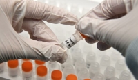 В Чеченской Республике умер девятый заболевший COVID-19