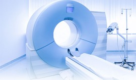 Новый подход к быстрой диагностике эпилепсии обнаружен в РФ