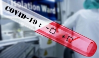 Минздрав РФ: Ситуация с COVID-19 в России тревожная