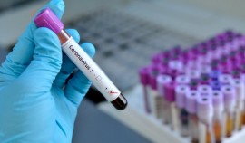 В ЧР на сегодняшний день первый компонент вакцины получили около 40% населения