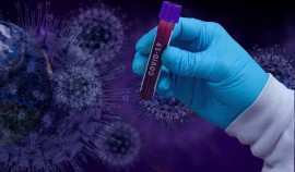Тест на COVID-19 может показать ложный отрицательный результат в 30-40% случаев, заявил эксперт