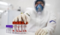Число заболевших коронавирусной инфекцией COVID-19 в России за сутки выросло на 2558
